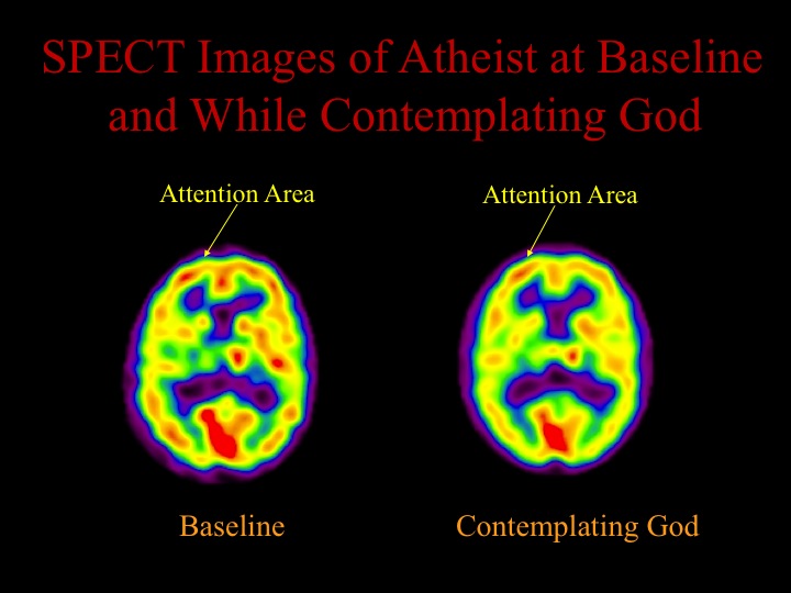 spect atheist at baseline and while contemplating god